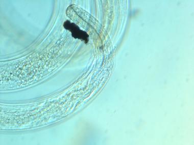 Head of a female nematode head of female nematode