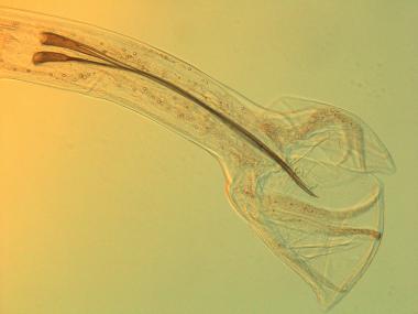 Tail of a male nematody male nematode tail